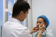 北京东方和谐面部填充案例