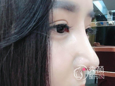 陈付国鼻修复技术好吗，有没有黑料?