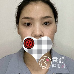 上海伊莱美李湘原鼻子做得怎么样,审美风格怎么样