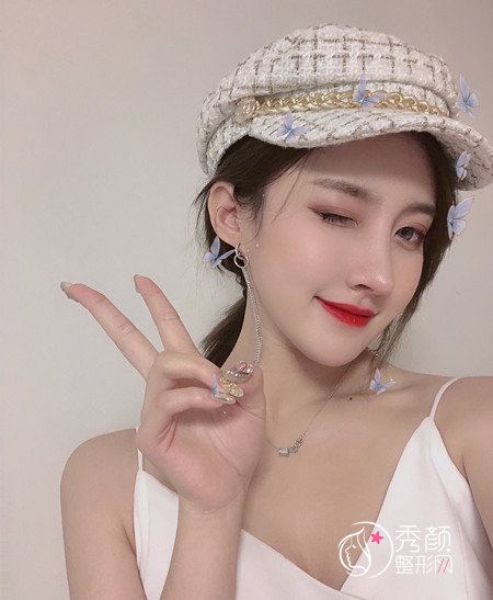 青岛华颜孙好杰隆鼻怎么样|案例曝光