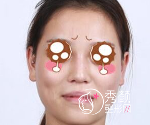 上海时光何晋龙磨骨怎么样，附何晋龙磨骨案例