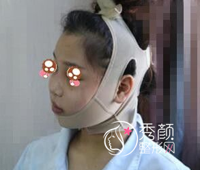 上海时光何晋龙磨骨怎么样，附何晋龙磨骨案例