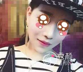 上海时光何晋龙磨骨怎么样，附何晋龙磨骨案例