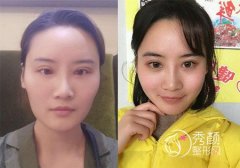 <b>李志海和金一秀谁磨骨好|价格案例对比</b>