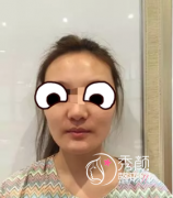 北京八大处有磨骨失败案例吗