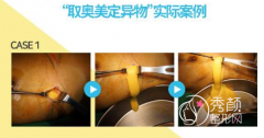 <b>取奥美定邓正军和齐云香哪个好|技术口碑对比</b>