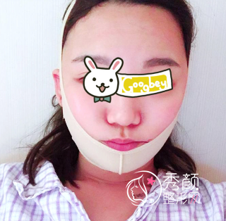 武汉亚韩赵贵庆磨骨怎么样|术前术后案例对比