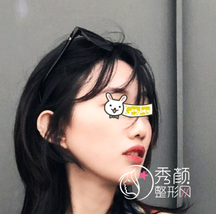 武汉亚韩赵贵庆磨骨怎么样|术前术后案例对比