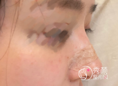 <b>整理几位网红隆鼻医生杜轶男|王艇|葛志鑫|李昕|任东|向宏伟特点分析</b>