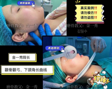 <b>金一秀和张柱允谁磨骨技术好</b>