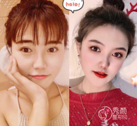 <b>上海百达丽王艳和喜美王会勇哪个鼻子修复好|技术案例对比</b>