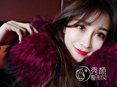 青岛华韩院长赵煜楠怎么样|面部填充案例