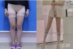 上海九院吸脂哪个医生好|上海九院抽脂价格表一览