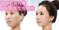 <b>国内颧骨内推较好的医生，看看都有哪些医生上榜</b>