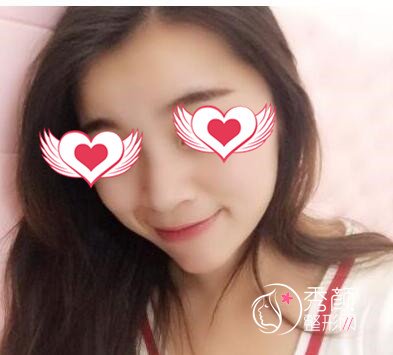 重庆华美华美李富强做脂肪填充怎么样|案例曝光