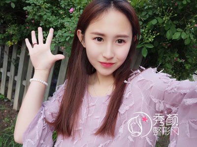 成都美莱黄小林做双眼皮怎么样|术前术后案例对比曝光