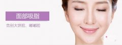 杭州面部吸脂公立医院哪家好