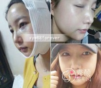 国内具有磨骨资质的医生_北京八大处颧骨下颌角磨骨医生整理