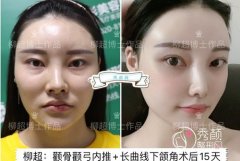 广州磨骨和广州美恩的穆雄铮谁的技术更好？