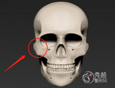 颧骨内推两年后脸必定下垂吗|颧骨内推下垂怎么办