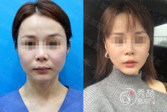 <b>北京加减美穆宝安和联合丽格杨大平哪个拉皮除皱技术好</b>