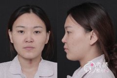 <b>选来选去还是找刘彦军做的鼻子,贵是贵了些但是好看就很值得了。</b>