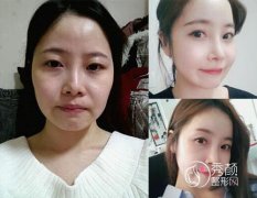 <b>沈阳名流整形医院王松医生技术怎么样,有没有失败案例?</b>