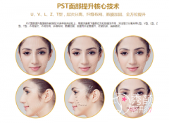 <b>pst面部提升怎么做,全脸pst面部提升多少钱,有没有后遗症</b>
