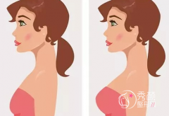 <b>上海伯思立医院殷初阳医生隆胸怎么样,有没有失败案例</b>