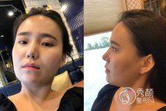 <b>武汉磨骨哪个医生好,武汉中翰吴中兴磨骨案例。</b>