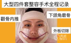 <b>重庆时光磨骨怎么样,大概需要多少钱,有没有失败案例?</b>