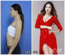 <b>武汉仁爱时光包涛隆胸怎么样,有没有失败案例?</b>