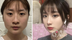 <b>广州美恩磨骨靠谱吗?磨骨大概需要多少钱?</b>