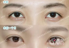 <b>国内知名双眼皮修复医生王世勇和王振军哪个技术更好?</b>