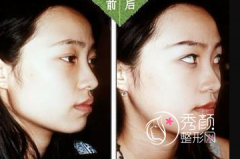 <b>重庆华美潘宝华和重庆时光姜民范哪个磨骨好呀?</b>