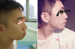 <b>上海九院王旭东做正颌手术技术怎么样,大概需要多少钱?</b>