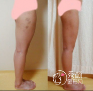 <b>上海九院吸脂技术怎么样,果好不好,贵不贵?</b>