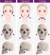 <b>北京圣嘉荣黄大勇磨骨做得好吗,有没有失败案例?</b>