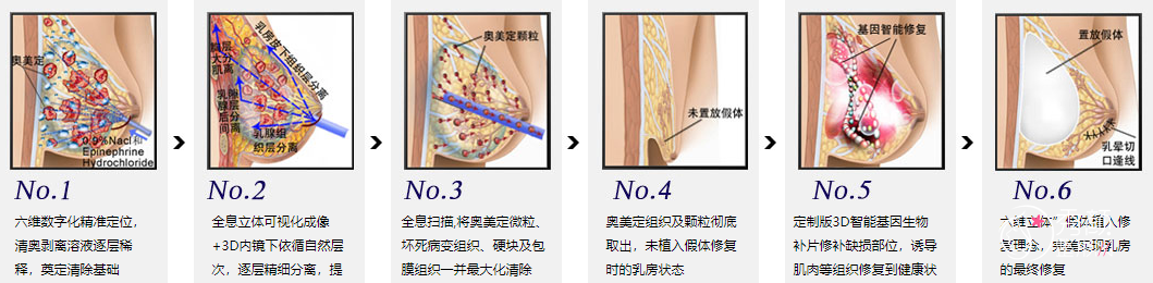 武汉取奥美定公立三甲医院：吴毅平取奥美定怎么样?