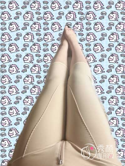 广州军美王世虎吸脂怎么样,有没有失败案例