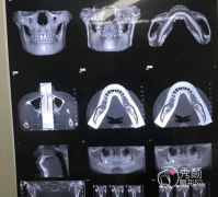 <b>上海港华杨君毅磨骨有失败案例吗？</b>