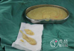 广州哪家医院可以取奥美定