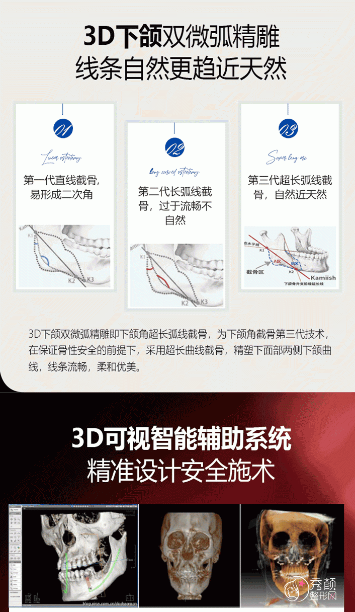 武汉亚韩赵贵庆磨骨技术怎么样,有没有失败案例?