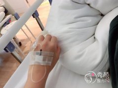 八大处曼托假体隆胸三个月泳装照都不在怕的！