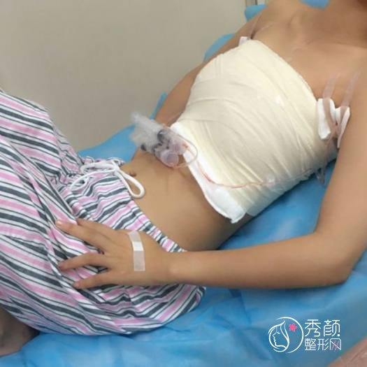 深圳富华唐新辉隆胸怎么样,有没有失败案例?