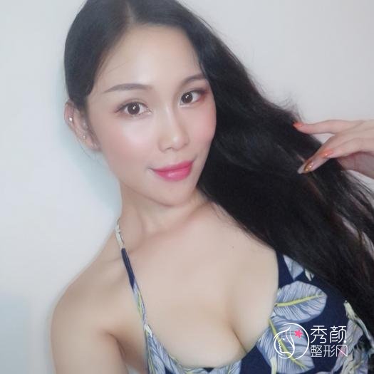 深圳富华唐新辉隆胸怎么样,有没有失败案例?