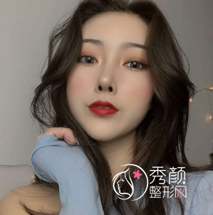 深圳美莱综合鼻整形手术怎么样