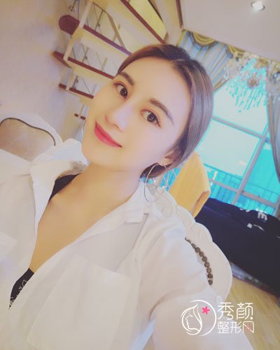 西安美莱杨帆医生隆鼻怎么样,有没有失败案例