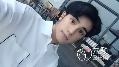 郑州东方整形的吴振隆鼻怎么样,有没有失败案例