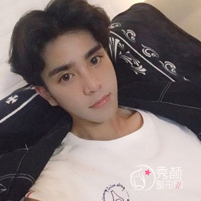 郑州东方整形的吴振隆鼻怎么样,有没有失败案例